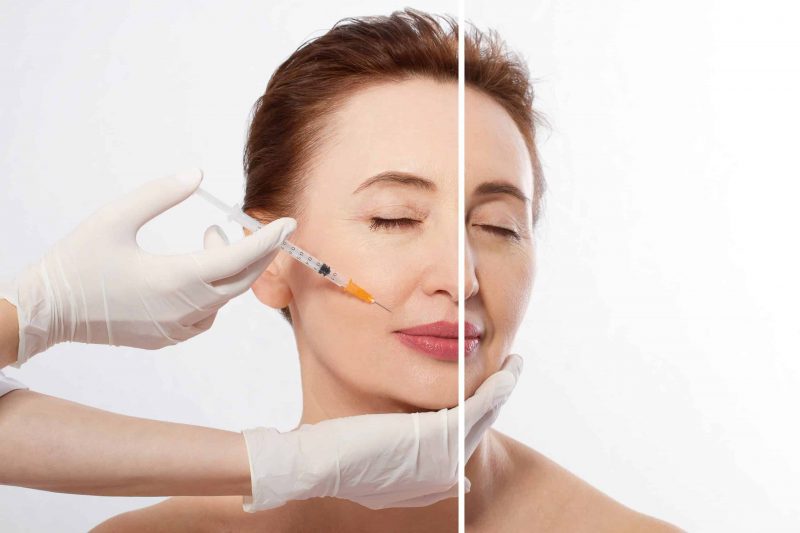 Bỏ Túi Ngay Top 6 Cơ Sở Học Tiêm Filler Tại Hà Nội Uy Tín - ma68.live Bỏ Túi Ngay Top 6 Cơ Sở Học Tiêm Filler Tại Hà Nội Uy Tín - ma68.live