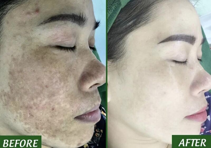 Top 10 Spa Long Biên Uy Tín, Chất Lượng Dành Cho Phái Đẹp - ma68.live
